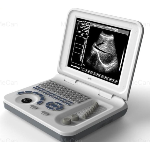 Апарат УЗД портативний "Dollimax" WBH-2300