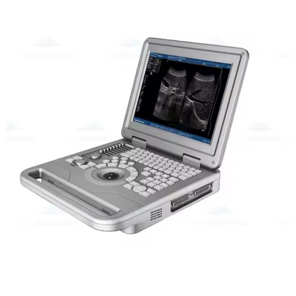 Апарат УЗД портативний "Dollimax" WBH-2500